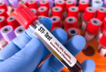 Top Reasons Young Adults Should Prioritize Dubai STI Testing Regularly
