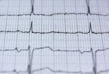 stellar apex beam pulse